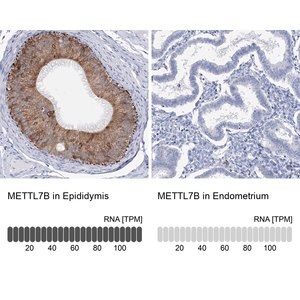 Merck Anti-METTL7B antibody produced in rabbit