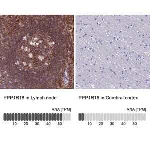 Merck Anti-PPP1R18 antibody produced in rabbit