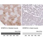 Merck Anti-MYBPC2 antibody produced in rabbit