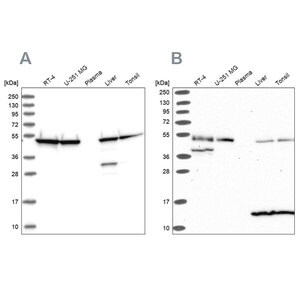 Merck Anti-ST13 antibody produced in rabbit