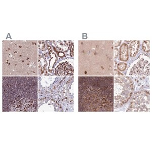 Merck Anti-TOR1AIP1 antibody produced in rabbit