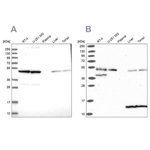 Merck Anti-ST13 antibody produced in rabbit