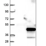 Merck Anti-ABHD17A antibody produced in rabbit