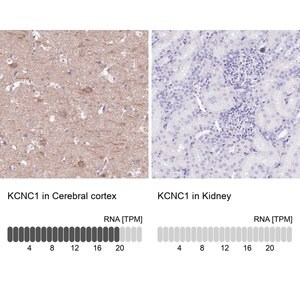 Merck Anti-KCNC1 antibody produced in rabbit