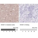 Merck Anti-KCNC1 antibody produced in rabbit