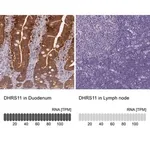 Merck Anti-DHRS11 antibody produced in rabbit