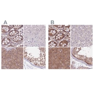 Merck Anti-PFDN6 antibody produced in rabbit