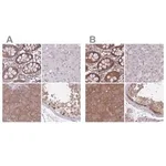Merck Anti-PFDN6 antibody produced in rabbit