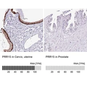 Merck Anti-PRR15 antibody produced in rabbit