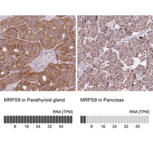 Merck Anti-MRPS9 antibody produced in rabbit
