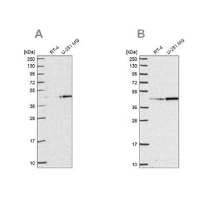 Merck Anti-WDR18 antibody produced in rabbit