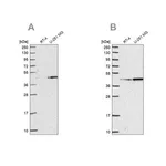 Merck Anti-WDR18 antibody produced in rabbit
