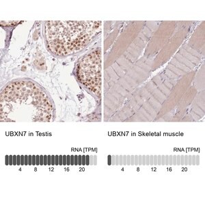 Merck Anti-UBXN7 antibody produced in rabbit