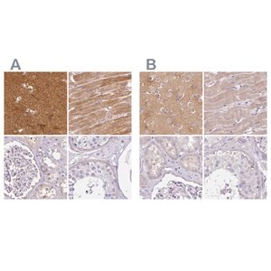 Merck Anti-CAP2 antibody produced in rabbit