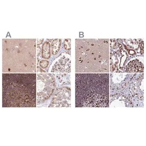 Merck Anti-TOR1AIP1 antibody produced in rabbit