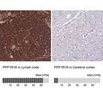 Merck Anti-PPP1R18 antibody produced in rabbit