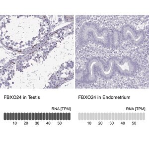 Merck Anti-FBXO24 antibody produced in rabbit