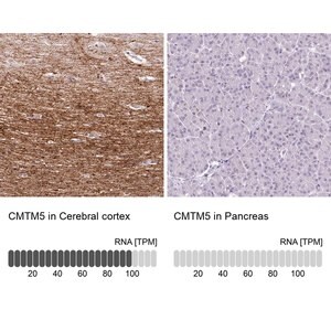 Merck Anti-CMTM5 antibody produced in rabbit