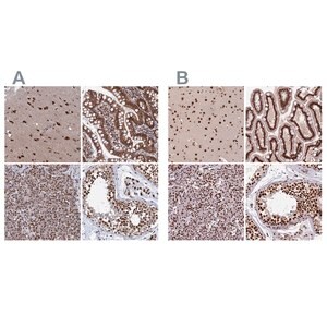 Merck Anti-CTB-50L17.10 antibody produced in rabbit