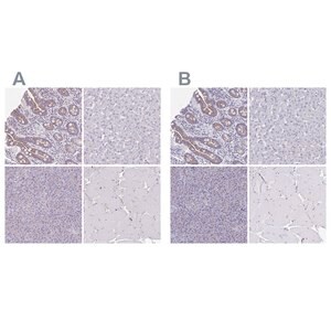 Merck Anti-CHMP5 antibody produced in rabbit