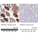 Merck Anti-MYBPC2 antibody produced in rabbit