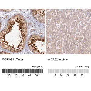 Merck Anti-WDR62 antibody produced in rabbit