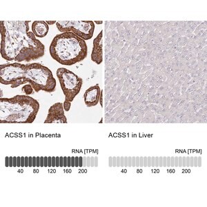 Merck Anti-ACSS1 antibody produced in rabbit