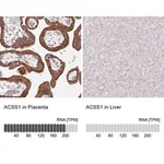 Merck Anti-ACSS1 antibody produced in rabbit