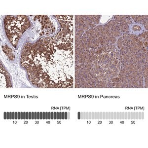 Merck Anti-MRPS9 antibody produced in rabbit