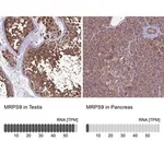 Merck Anti-MRPS9 antibody produced in rabbit