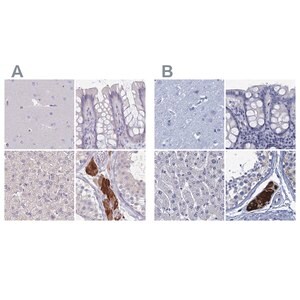 Merck Anti-CYP51A1 antibody produced in rabbit
