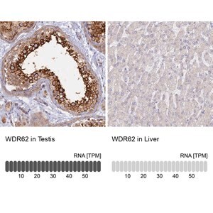 Merck Anti-WDR62 antibody produced in rabbit