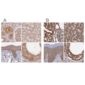 Merck Anti-PSMD9 antibody produced in rabbit