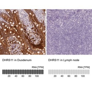Merck Anti-DHRS11 antibody produced in rabbit