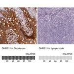 Merck Anti-DHRS11 antibody produced in rabbit