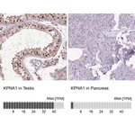 Merck Anti-KPNA1 antibody produced in rabbit
