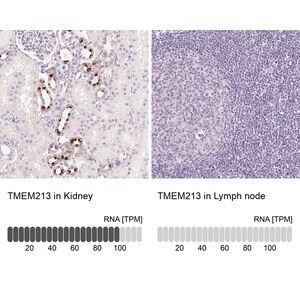 Merck Anti-TMEM213 antibody produced in rabbit