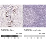 Merck Anti-TMEM213 antibody produced in rabbit