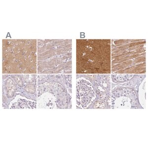 Merck Anti-CAP2 antibody produced in rabbit