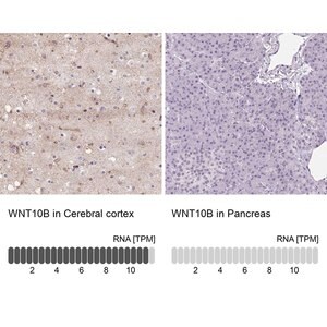 Merck Anti-WNT10B antibody produced in rabbit