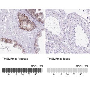 Merck Anti-TMEM79 antibody produced in rabbit