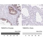 Merck Anti-TMEM79 antibody produced in rabbit