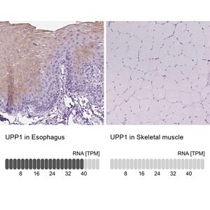 Merck Anti-UPP1 antibody produced in rabbit