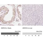 Merck Anti-ZNF610 antibody produced in rabbit