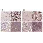 Merck Anti-RPS5 antibody produced in rabbit