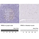 Merck Anti-RRM2 antibody produced in rabbit
