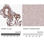 Merck Anti-COL8A1 antibody produced in rabbit