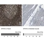 Merck Anti-STK10 antibody produced in rabbit