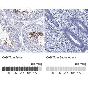 Merck Anti-CABYR antibody produced in rabbit