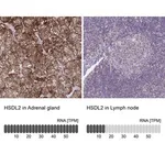 Merck Anti-HSDL2 antibody produced in rabbit